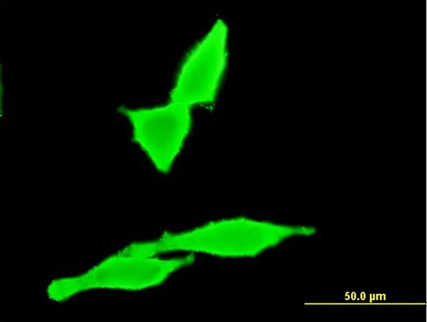 Immunofluorescence of monoclonal antibody to CNR2 on HeLa cell . [antibody concentration 10 ug/ml]