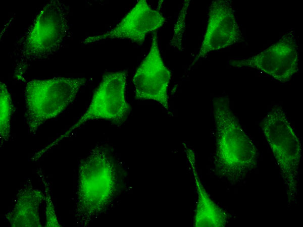 Immunofluorescence of monoclonal antibody to FAU on HeLa cell . [antibody concentration 10 ug/ml]