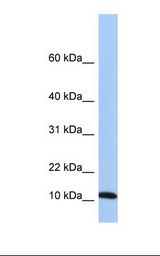 721_B cell lysate. Antibody concentration: 1.0 ug/ml. Gel concentration: 10-20%.