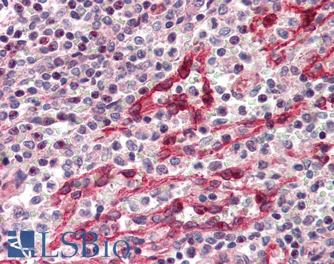 Anti-CNR2 / CB2 antibody IHC of human spleen. Immunohistochemistry of formalin-fixed, paraffin-embedded tissue after heat-induced antigen retrieval. Antibody LS-B2263 dilution 1:100.