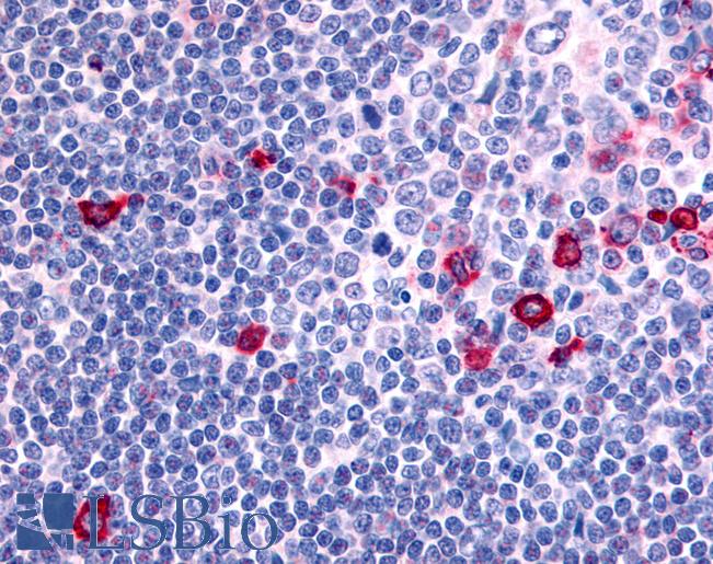 Anti-CNR2 / CB2 antibody IHC of human tonsil. Immunohistochemistry of formalin-fixed, paraffin-embedded tissue after heat-induced antigen retrieval.