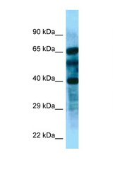 FBXL8 antibody LS-C146305 Western blot of Fetal Kidney lysate. Antibody concentration 1 ug/ml.