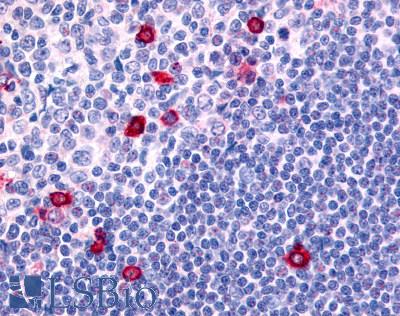 Anti-CNR2 / CB2 antibody LS-A36 IHC of human germinal center and mantle zone. Immunohistochemistry of formalin-fixed, paraffin-embedded tissue after heat-induced antigen retrieval.