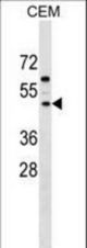 FBXL8 Antibody western blot of CEM cell line lysates (35 ug/lane). The FBXL8 antibody detected the FBXL8 protein (arrow).