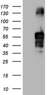 HEK293T cells were transfected with the pCMV6-ENTRY control (Left lane) or pCMV6-ENTRY FBLIM1 (Right lane) cDNA for 48 hrs and lysed. Equivalent amounts of cell lysates (5 ug per lane) were separated by SDS-PAGE and immunoblotted with anti-FBLIM1.
