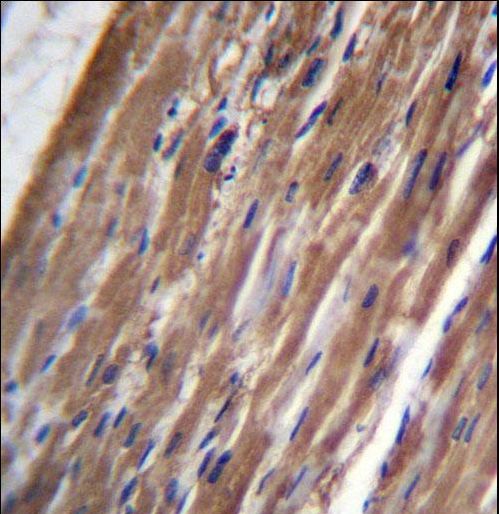 FBLIM1 Antibody immunohistochemistry of formalin-fixed and paraffin-embedded human heart tissue followed by peroxidase-conjugated secondary antibody and DAB staining.