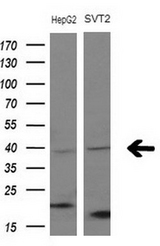 Western blot of extracts (10ug) from 2 different cell lines by using anti-FBLIM1 monoclonal antibody at 1:200 dilution.