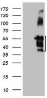 HEK293T cells were transfected with the pCMV6-ENTRY control (Left lane) or pCMV6-ENTRY FBLIM1 (Right lane) cDNA for 48 hrs and lysed. Equivalent amounts of cell lysates (5 ug per lane) were separated by SDS-PAGE and immunoblotted with anti-FBLIM1.