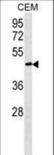 FBLN5 Antibody western blot of CEM cell line lysates (35 ug/lane). The FBLN5 antibody detected the FBLN5 protein (arrow).