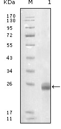 Western blot using FBLN5 mouse monoclonal antibody against truncated FBLN5-His recombinant protein.