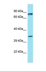 Western blot of Human OVCAR-3. FBLN7 antibody dilution 1.0 ug/ml.