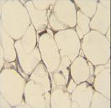 FBLN7 Antibody immunohistochemistry of formalin-fixed and paraffin-embedded human adipose tissue followed by peroxidase-conjugated secondary antibody and DAB staining.