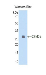 Western blot of recombinant FBN2 / Fibrillin 2.
