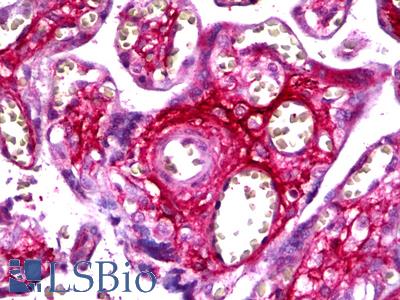 Anti-FBN2 / Fibrillin 2 antibody IHC of human prostate, extra cellular. Immunohistochemistry of formalin-fixed, paraffin-embedded tissue after heat-induced antigen retrieval. Antibody LS-B6338 dilution 1:100.