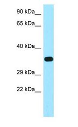 FBP / FOLR2 antibody Western Blot of MCF7.