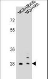 FOLR2 Antibody western blot of MDA-MB453,NCI-H460 cell line lysates (35 ug/lane). The FOLR2 antibody detected the FOLR2 protein (arrow).