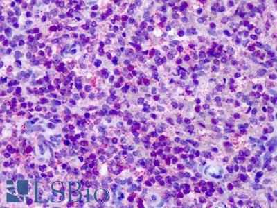 Anti-CNR2 / CB2 antibody IHC of human spleen. Immunohistochemistry of formalin-fixed, paraffin-embedded tissue after heat-induced antigen retrieval. Antibody LS-A35 dilution 11 ug/ml.
