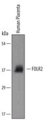 Detection of Human FOLR2 by Western Blot. Western blot shows lysates of human placental tissue. PVDF membrane was probed with 1 ug/ml of Human FOLR2 Antigen Affinity-purified Polyclonal Antibody followed by HRP-conjugated Anti-Sheep IgG Secondary Antibody. A specific band was detected for FOLR2 at approximately 38 kD (as indicated). This experiment was conducted under reducing conditions.