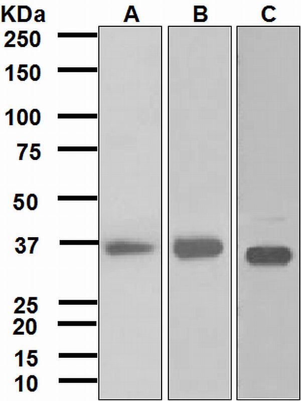 Western blot analysis on (A) human stomach, (B) fetal liver, and (C) MCF-7 lysates using anti-FBP1 antibody.