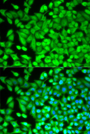 Immunofluorescence analysis of MCF-7 cell using FBP1 antibody. Blue: DAPI for nuclear staining.