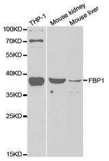 Western blot analysis of extracts of various cell lines, using FBP1 antibody.