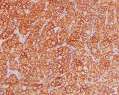 IHC of paraffin-embedded human liver tissue using anti-FBP1 antibody.
