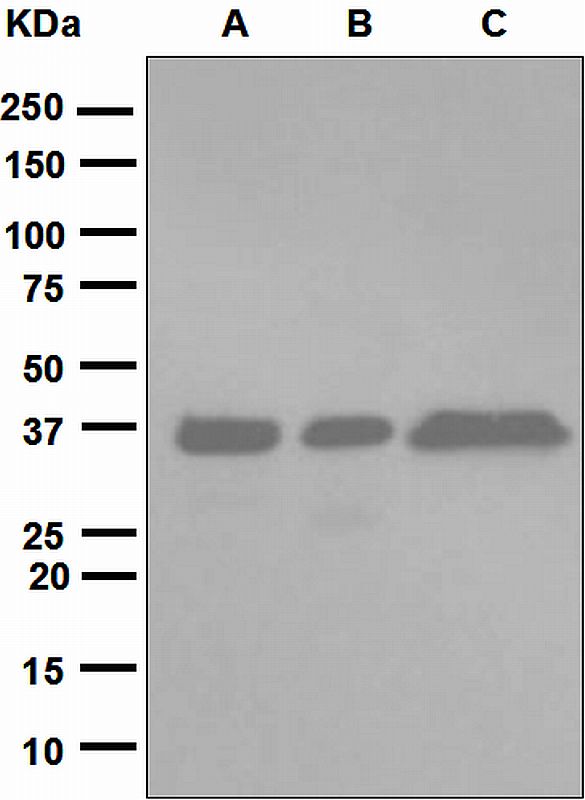 Western blot analysis on (A) MCF-7, (B) fetal liver, and (C) HL-60 treated with vitamin D3 lysates using anti-FBP1 antibody.
