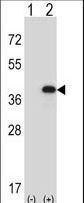 Western blot of FBP1 (arrow) using rabbit polyclonal FBP1 Antibody. 293 cell lysates (2 ug/lane) either nontransfected (Lane 1) or transiently transfected (Lane 2) with the FBP1 gene.