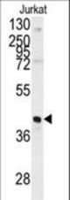 Western blot of FBP1 antibody in Jurkat cell line lysates (35 ug/lane). FBP1 (arrow) was detected using the purified antibody.