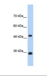 Jurkat cell lysate. Antibody concentration: 1.25 ug/ml. Gel concentration: 12%.
