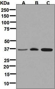 Western blot analysis on (A) fetal kidney, (B) human skeletal muscle, and (C) fetal liver lysates using anti-FBP2 antibody.