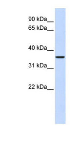 FBP2 antibody LS-C102272 Western blot of Fetal Muscle lysate.