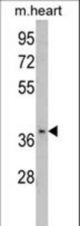 Western blot of FBP2 Antibody in mouse heart tissue lysates (35 ug/lane). FBP2 (arrow) was detected using the purified antibody.