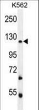 FBRSL1 Antibody western blot of K562 cell line lysates (35 ug/lane). The FBRSL1 antibody detected the FBRSL1 protein (arrow).