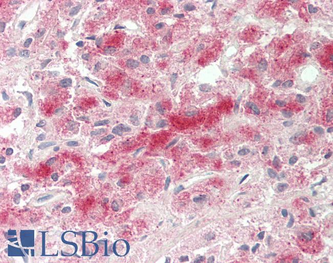 FBXO9 antibody western blot of NCI-H226 cell lysate.