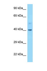 CNR2 / CB2 antibody LS-C146177 Western blot of 721_B Cell lysate. Antibody concentration 1 ug/ml.