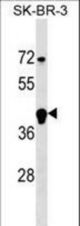 FBXL12 Antibody western blot of SK-BR-3 cell line lysates (35 ug/lane). The FBXL12 antibody detected the FBXL12 protein (arrow).