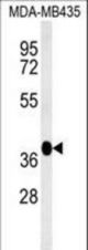 FBXL14 Antibody western blot of MDA-MB435 cell line lysates (35 ug/lane). The FBXL14 antibody detected the FBXL14 protein (arrow).