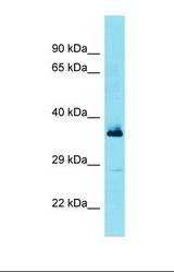 Western blot of Fetal Lung. FBXL15 antibody dilution 1.0 ug/ml.