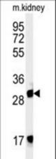 Western blot of FBXL15 Antibody in mouse kidney tissue lysates (35 ug/lane). FBXL15 (arrow) was detected using the purified antibody.