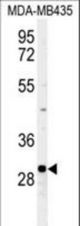 Western blot of FBXL15 Antibody (RB26324) in MDA-MB435 cell line lysates (35 ug/lane). FBXL15 (arrow) was detected using the purified antibody.