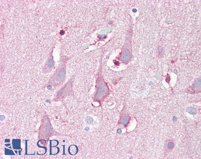 Anti-FBXL16 antibody IHC of human brain, cortex. Immunohistochemistry of formalin-fixed, paraffin-embedded tissue after heat-induced antigen retrieval. Antibody LS-B7030 concentration 5 ug/ml.