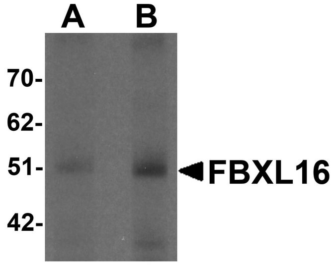 Western blot analysis of FBXL16 in human spleen tissue lysate with FBXL16 antibody at (A) 0.5 and (B) 1 ug/ml.