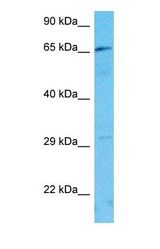 Western blot of FBXL19 Antibody with human Jurkat Whole Cell lysate.