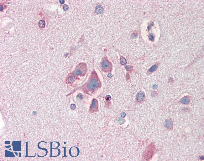 Anti-FBXL2 antibody IHC staining of human brain, cortex. Immunohistochemistry of formalin-fixed, paraffin-embedded tissue after heat-induced antigen retrieval. Antibody LS-B10277 concentration 10 ug/ml.