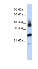 FBXL2 antibody LS-C101999 Western blot of Transfected 293T cell lysate.