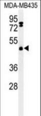 Western blot of FBXL2 Antibody in MDA-MB435 cell line lysates (35 ug/lane). FBXL2 (arrow) was detected using the purified antibody.