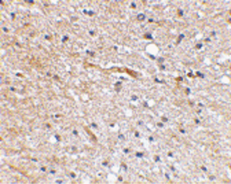 Immunohistochemical staining of human brain tissue using Scrapper antibody at 2.5 ug/ml.