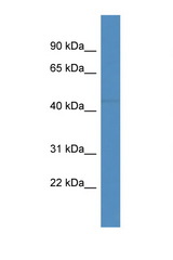 FBXL20 antibody LS-C135863 Western blot of COL0205 Cell lysate. Antibody concentration 1 ug/ml.