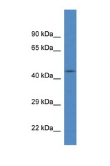 FBXL20 antibody LS-C135864 Western blot of Fetal Brain lysate. Antibody concentration 1 ug/ml.